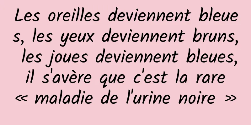 Les oreilles deviennent bleues, les yeux deviennent bruns, les joues deviennent bleues, il s'avère que c'est la rare « maladie de l'urine noire »