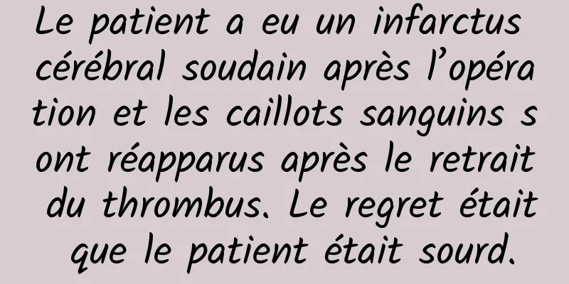 Le patient a eu un infarctus cérébral soudain après l’opération et les caillots sanguins sont réapparus après le retrait du thrombus. Le regret était que le patient était sourd.