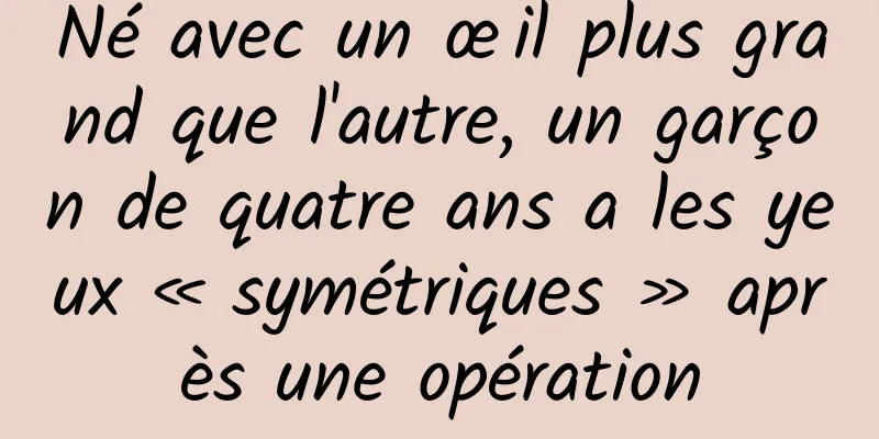Né avec un œil plus grand que l'autre, un garçon de quatre ans a les yeux « symétriques » après une opération