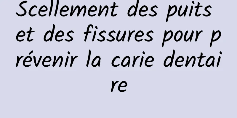 Scellement des puits et des fissures pour prévenir la carie dentaire