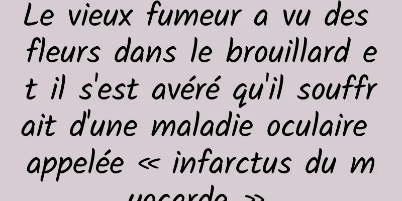 Le vieux fumeur a vu des fleurs dans le brouillard et il s'est avéré qu'il souffrait d'une maladie oculaire appelée « infarctus du myocarde ».