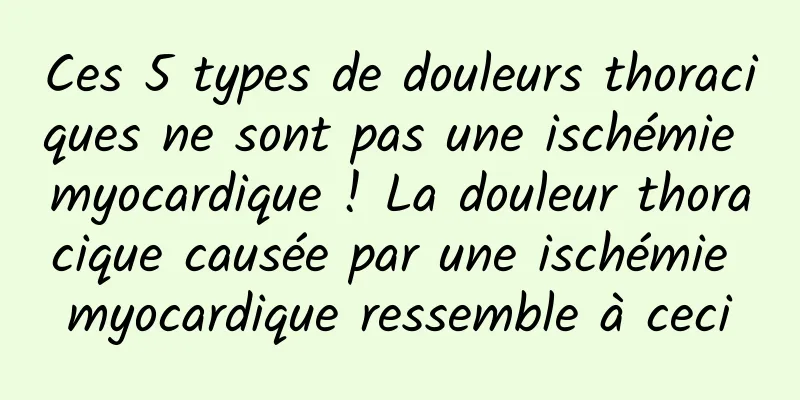 Ces 5 types de douleurs thoraciques ne sont pas une ischémie myocardique ! La douleur thoracique causée par une ischémie myocardique ressemble à ceci