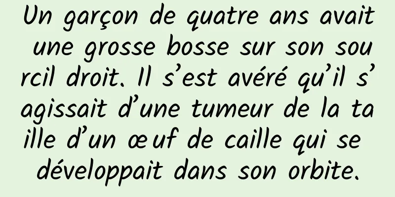 Un garçon de quatre ans avait une grosse bosse sur son sourcil droit. Il s’est avéré qu’il s’agissait d’une tumeur de la taille d’un œuf de caille qui se développait dans son orbite.