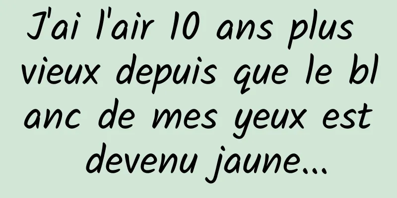 J'ai l'air 10 ans plus vieux depuis que le blanc de mes yeux est devenu jaune...