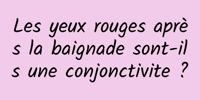 Les yeux rouges après la baignade sont-ils une conjonctivite ?