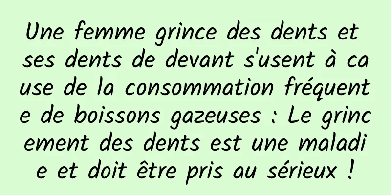 Une femme grince des dents et ses dents de devant s'usent à cause de la consommation fréquente de boissons gazeuses : Le grincement des dents est une maladie et doit être pris au sérieux !