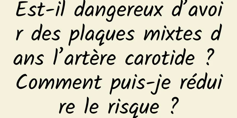 Est-il dangereux d’avoir des plaques mixtes dans l’artère carotide ? Comment puis-je réduire le risque ?