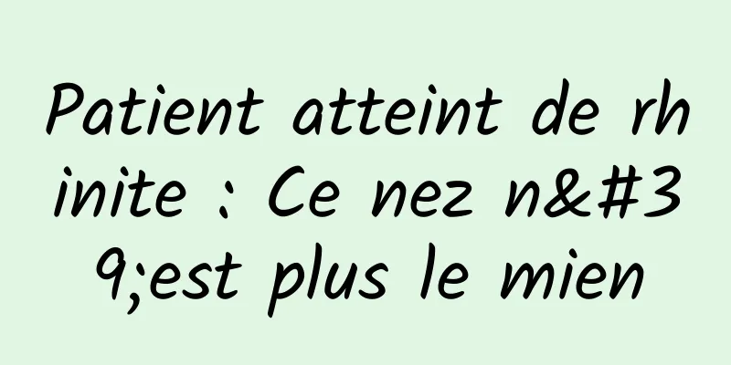 Patient atteint de rhinite : Ce nez n'est plus le mien