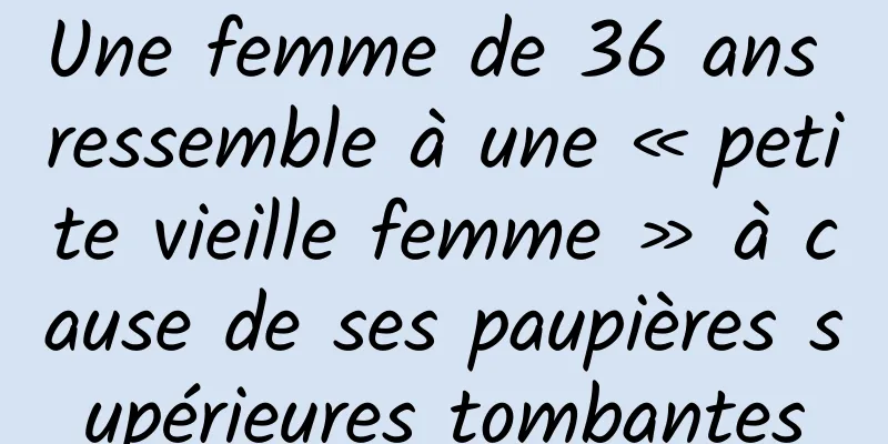 Une femme de 36 ans ressemble à une « petite vieille femme » à cause de ses paupières supérieures tombantes