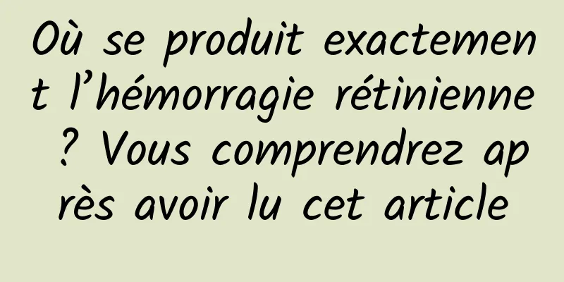 Où se produit exactement l’hémorragie rétinienne ? Vous comprendrez après avoir lu cet article
