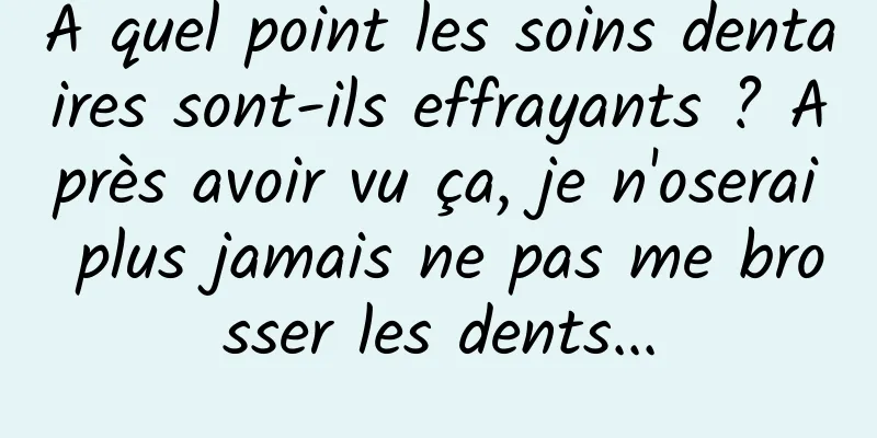 À quel point les soins dentaires sont-ils effrayants ? Après avoir vu ça, je n'oserai plus jamais ne pas me brosser les dents...