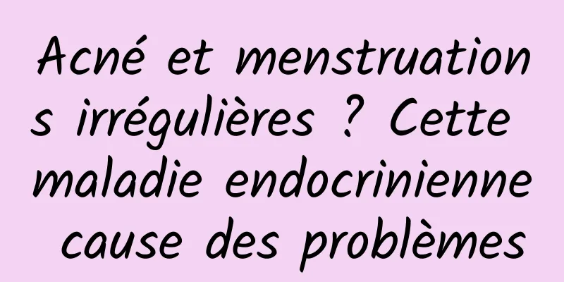 Acné et menstruations irrégulières ? Cette maladie endocrinienne cause des problèmes