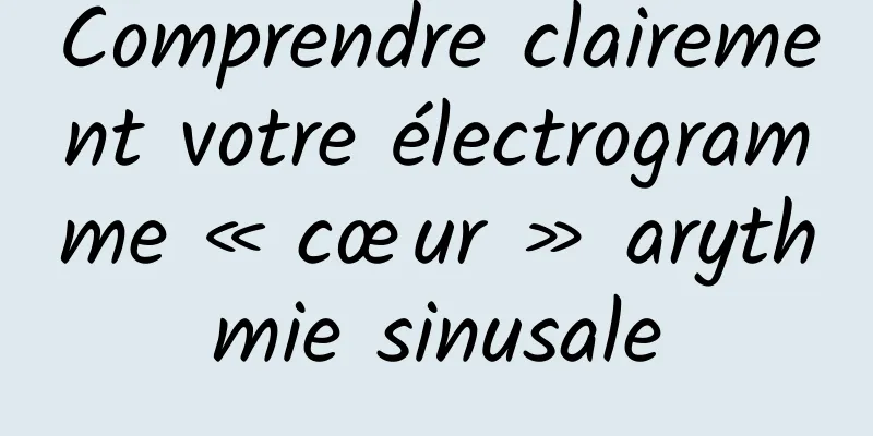 Comprendre clairement votre électrogramme « cœur » arythmie sinusale