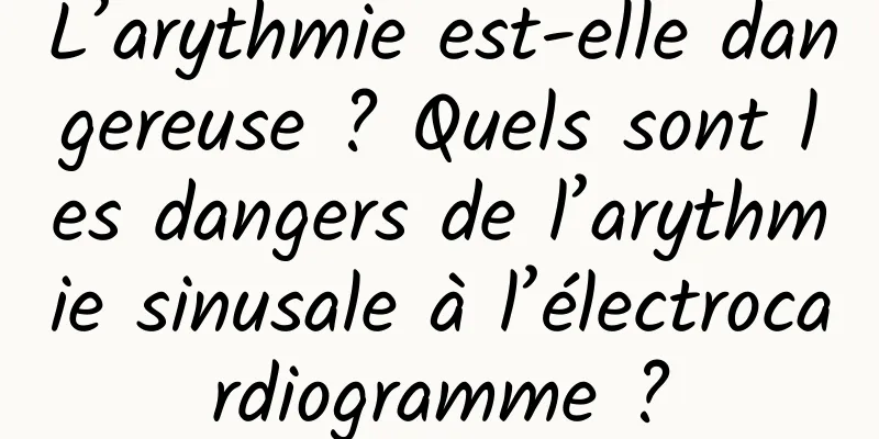 L’arythmie est-elle dangereuse ? Quels sont les dangers de l’arythmie sinusale à l’électrocardiogramme ?