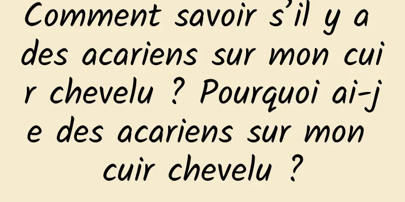 Comment savoir s’il y a des acariens sur mon cuir chevelu ? Pourquoi ai-je des acariens sur mon cuir chevelu ?