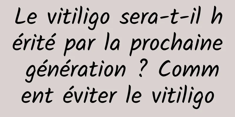 Le vitiligo sera-t-il hérité par la prochaine génération ? Comment éviter le vitiligo